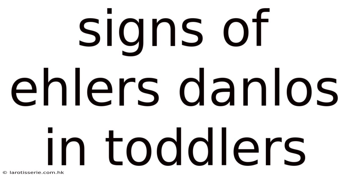 Signs Of Ehlers Danlos In Toddlers